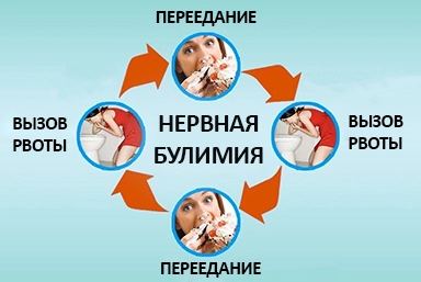 Лечение булимии в Отрадном